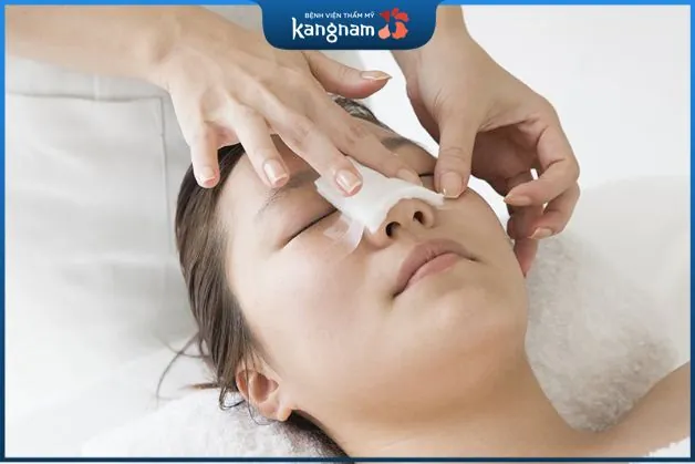 Cách chăm sóc sau nâng mũi cấu trúc Idol Line