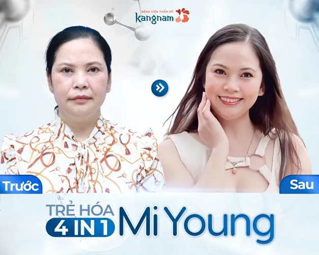 Khách hàng trẻ ra 10 tuổi nhờ công nghệ Mi Young