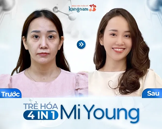 Lấy lại tuổi thanh xuân với trẻ hóa Mi Young