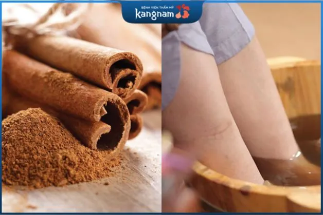 Quế có tính năng kháng khuẩn và khử mùi tự nhiên