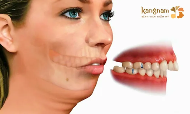 Có nhiều cấp độ hô khác nhau