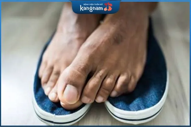 cách chữa hôi chân