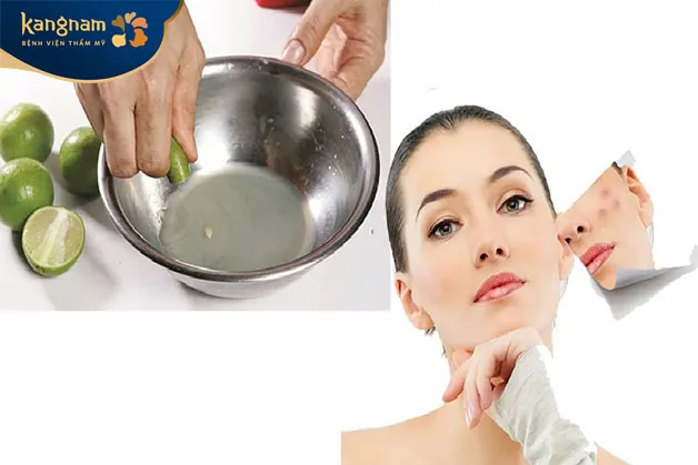 Đắp những lát chanh mỏng lên vùng bị mụn để giảm viêm