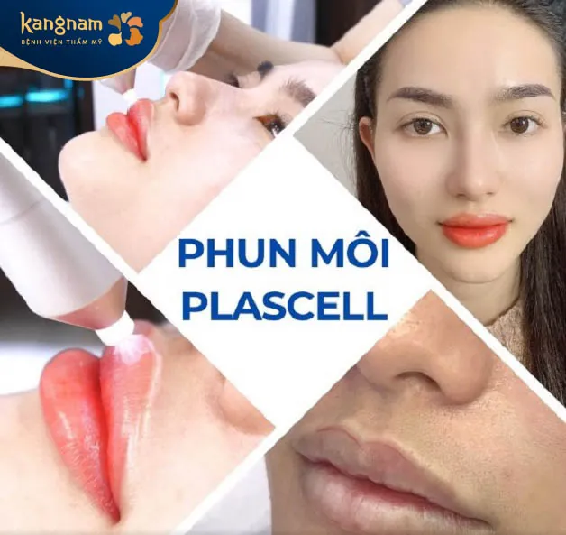 Công nghệ phun môi plascell