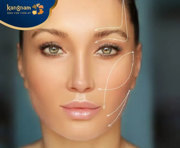 ưu điểm của phương pháp căng da bằng chỉ sinh học