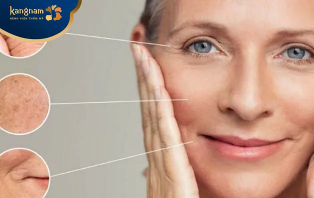 Đối tượng nên căng da bằng chỉ sinh học