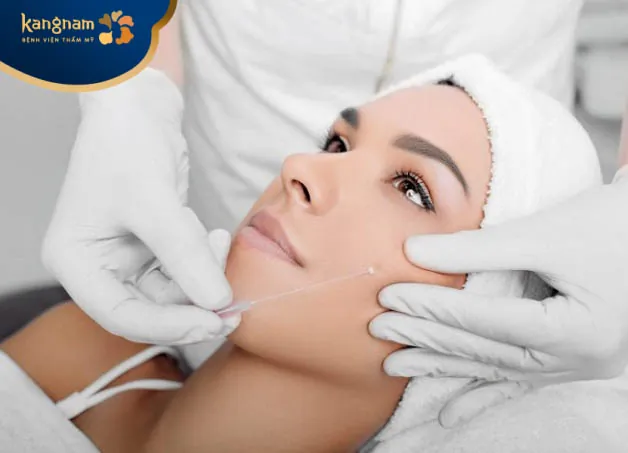 Căng chỉ sinh học là gì?