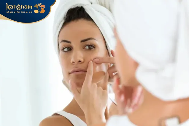 Không nên tự ý nặn mụn nang tại nhà