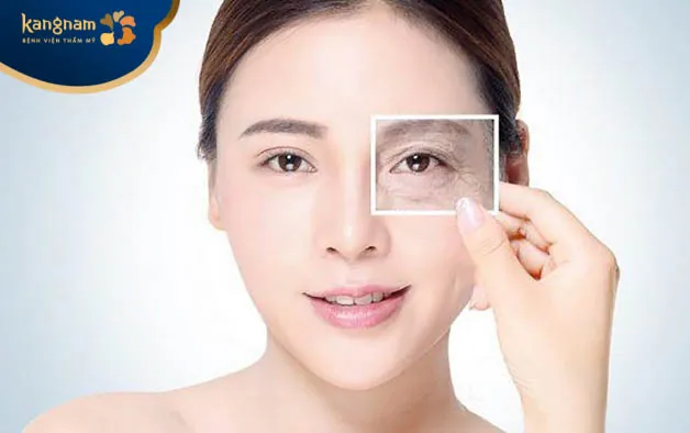 Tiêm botox làm trẻ hóa, tăng độ đàn hồi cho da