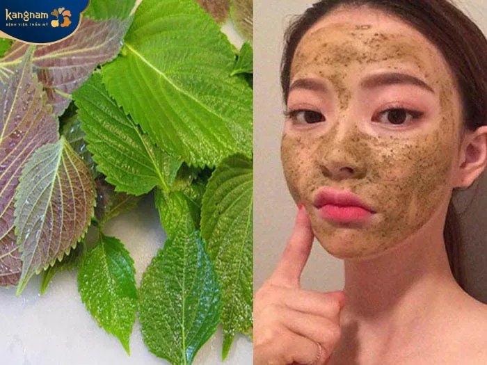 Mụn trứng cá xẹp nhanh chóng chỉ sau 1 đêm với lá tía tô