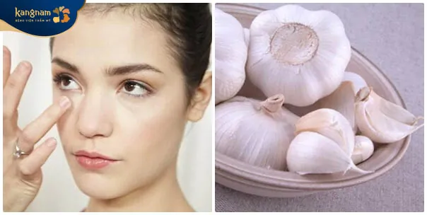 Tỏi một trong những cách làm xẹp mụn trứng cá nhanh chóng, hiệu quả, an toàn