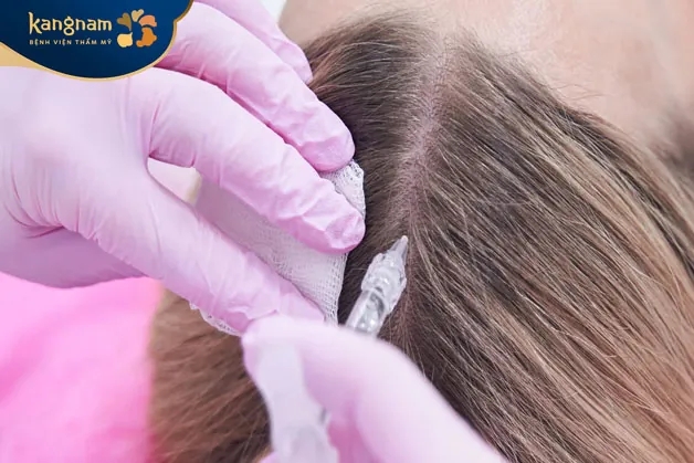 phụ nữ đang cho con bú là nên tránh tiêm Meso