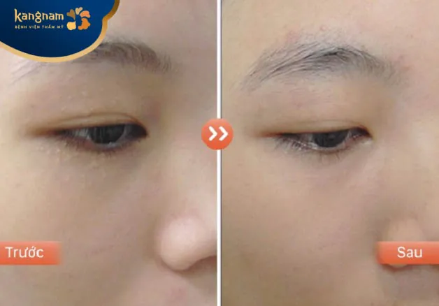 Lựa chọn địa chỉ trị mụn uy tín để đảm bảo kết quả tốt nhất