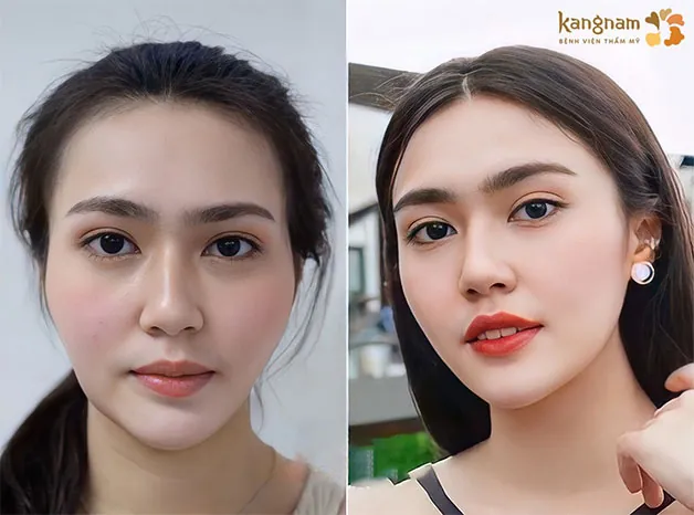 Những đường nét được sắc sảo hơn nhiều