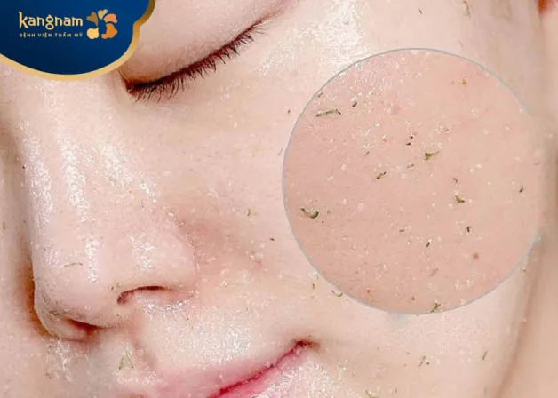 Thường xuyên tẩy tế bào chết cho da