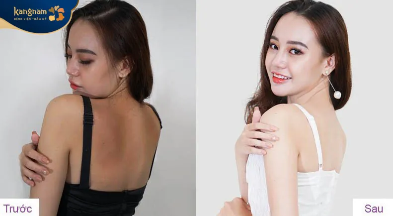 Cải thiện làn da thâm sạm, da đẹp không tì vết và khỏe khoắn hơn.