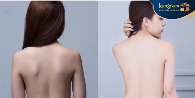 Da sáng mịn màng, không tì vết