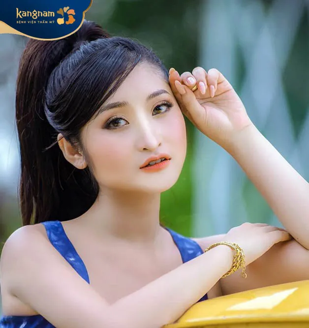 Diễn viên Hồng Anh trước khi phẫu thuật với khuyết điểm hàm vuông bạnh, mũi quặp