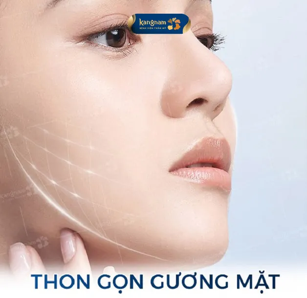 Những người có nhu cầu làm thon gọn mặt có thể lựa chọn phương pháp căng chỉ này
