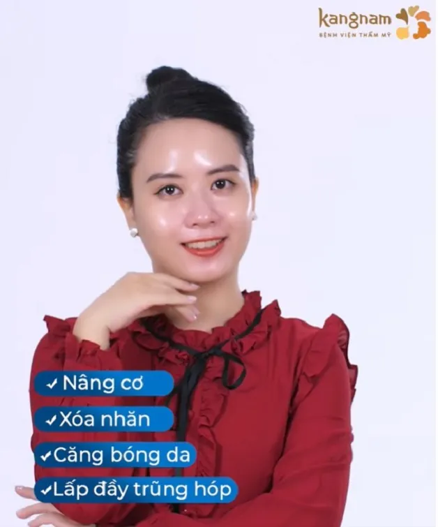 Căng chỉ công nghệ Bio Xline mang lại hiệu quả rõ rệt, nhanh chóng