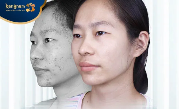 Xây dựng phác đồ điều trị cá nhân hóa, chuyên sâu để mang lại hiệu quả tối ưu nhất