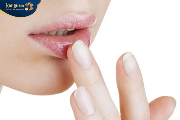 Hãy sử dụng kem đặc trị do bác sĩ kê để giải quyết triệt để tình trạng mụn ở môi