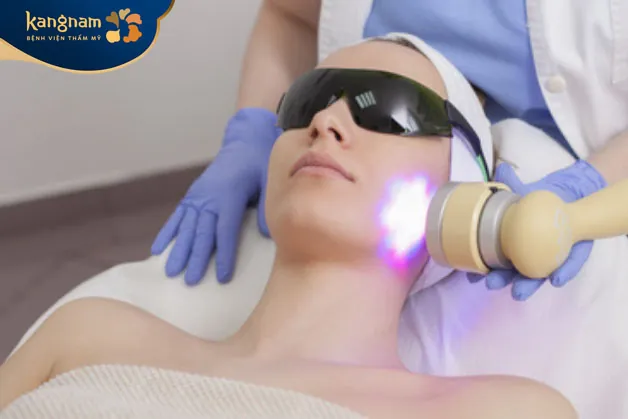 Da trở nên thô ráp hơn, dễ bong tróc đỏ nhẹ sau khi chiếu tia laser