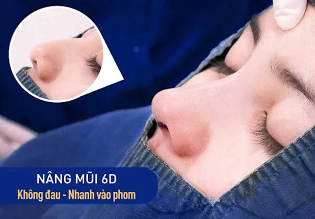 Nâng mũi 6D không đau - Trải nghiệm nâng mũi nhẹ nhàng nhất