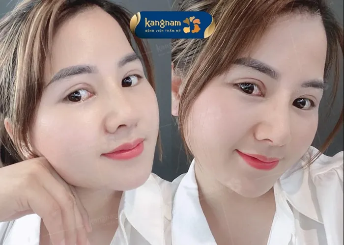 Khả năng hồi phục nhanh gấp 2 lần so với bình thường