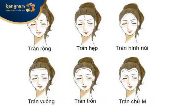 Dáng trán của phụ nữ là đặc điểm tướng số để nhận định tính cách