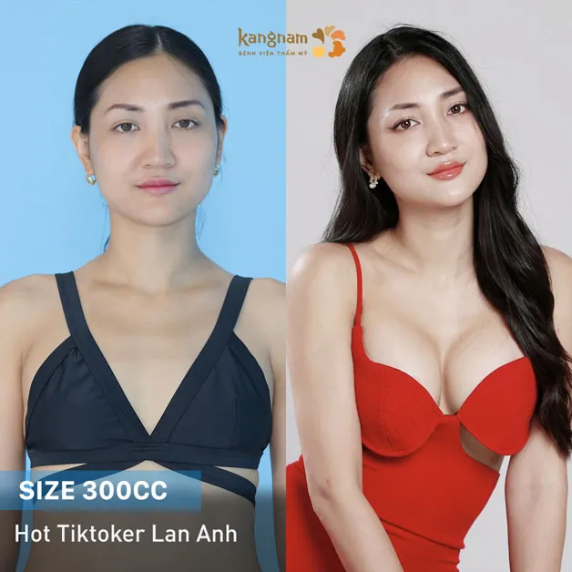 Nâng cấp bản thân, nâng cấp vòng 1