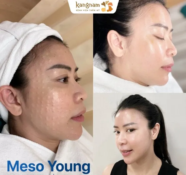 Làn da trở nên đàn hồi, săn chắc hơn