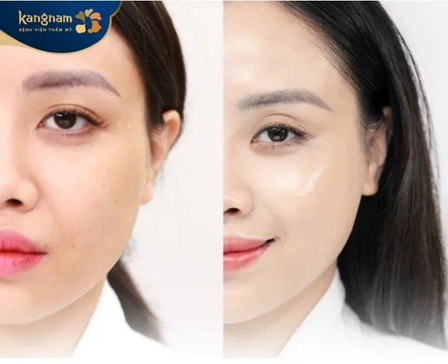 Da trở nên mịn màng hơn, và các vết thâm do tác động của môi trường giảm đi đáng kể