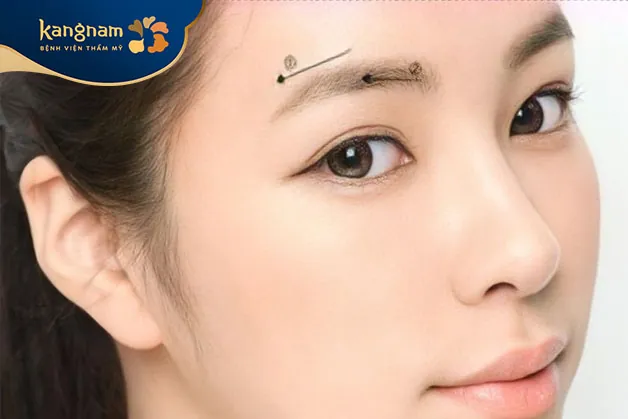 nâng cung mày còn giải cứu tình trạng da xệ, chùng nhão