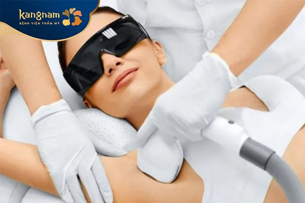 Triệt mồ hôi nách bằng laser
