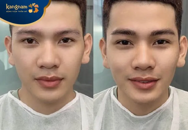 Kết quả điêu khắc lông mày tại Kangnam đẹp như ý và bền lâu