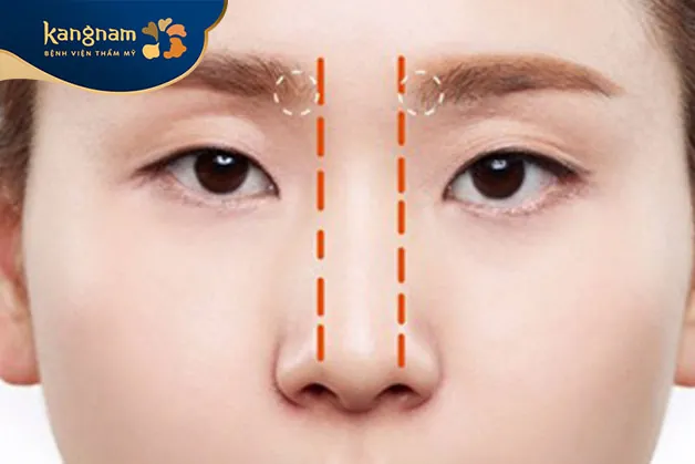 Sống mũi cao tạo điểm nhấn cho khuôn mặt