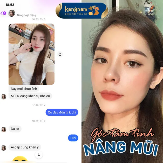 Bạn khách đáng yêu nhận được nhiều lời khen sau khi nâng mũi