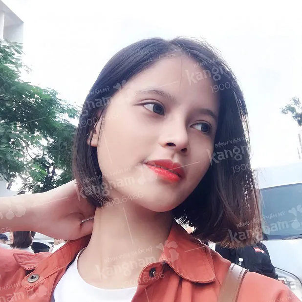 Mũi S Line tự nhiên như thật