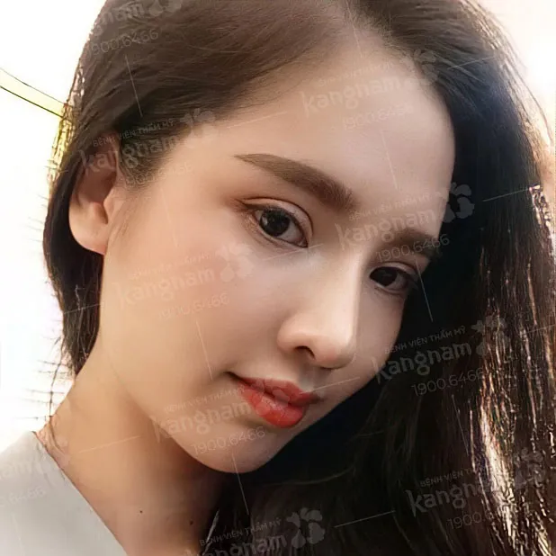 Dáng mũi S Line mềm mại, thanh tú