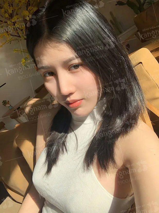 Sống mũi cao bay nhẹ nhàng, hợp với gương mặt Á Đông