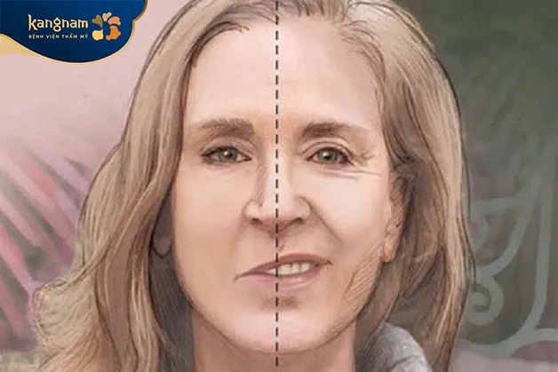 Một số bệnh lý có thể khiến mặt lệch