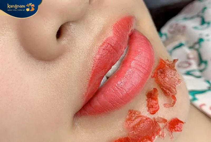 Môi bong tự nhiên sau vài ngày phun môi