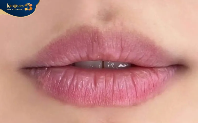 Môi lên màu không đều, chỗ đậm chỗ nhạt