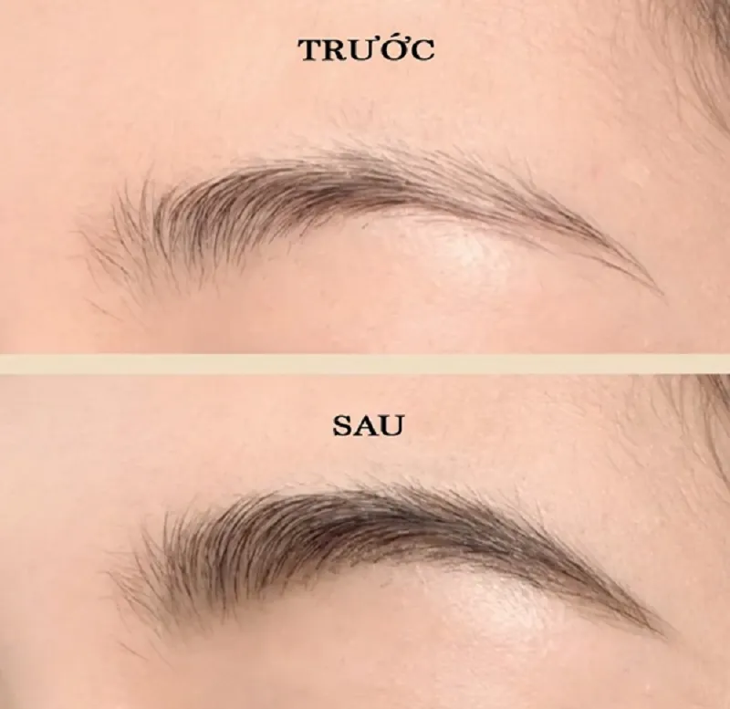 Cấy lông mày có ưu điểm duy trì hiệu quả lâu dài
