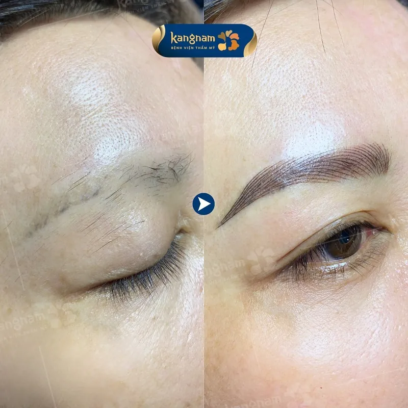 Điêu khắc lông mày xen kẽ với lông mày thật để tạo hiệu ứng tự nhiên