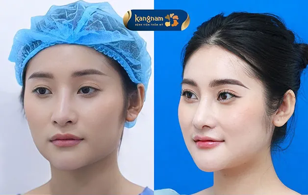 Diễn viên Hồng Anh sở hữu gương mặt thon gọn, chuẩn tỉ lệ vàng