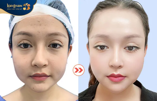 Phẫu thuật an toàn, không xấm lấn mang lại hiệu quả lâu dài