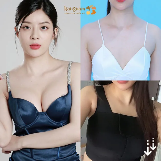 Thần thái tự tin hơn sau khi trùng tu vòng 1