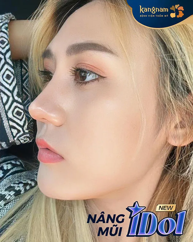 Có ngay diện mạo xinh đẹp sau khi nâng mũi cấu trúc tại Kangnam